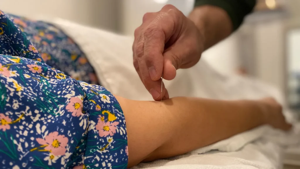 navigating your ivf journey could acupuncture be your trusted ally?